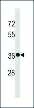 ANTI-GSX2 (C-TERM) antibody produced in rabbit IgG fraction of antiserum, buffered aqueous solution