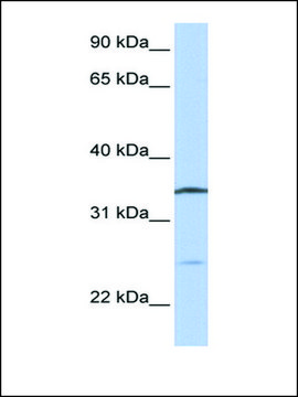 Anti-OCIAD1 antibody produced in rabbit affinity isolated antibody