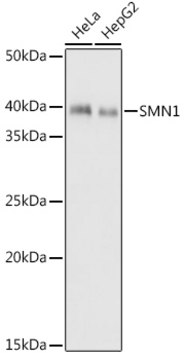 Anti-SMN1 Antibody, clone 9N9Q6, Rabbit Monoclonal