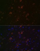 Anti-Huntingtin antibody produced in rabbit