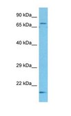 Anti-GLS antibody produced in rabbit affinity isolated antibody