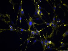 OSUMMER.12 Mouse NRAS-Mutant Melanoma Cell Line