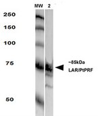 Monoclonal Anti-Lrrk2/Dardarin - Atto 594 antibody produced in mouse clone S138-6, purified immunoglobulin