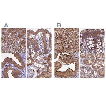 Anti-STUB1 antibody produced in rabbit Prestige Antibodies&#174; Powered by Atlas Antibodies, affinity isolated antibody, buffered aqueous glycerol solution