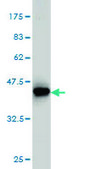 Monoclonal Anti-MVD antibody produced in mouse clone 2A7, purified immunoglobulin, buffered aqueous solution