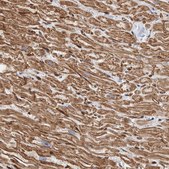 Anti-PKD1L1 antibody produced in rabbit Prestige Antibodies® Powered by Atlas Antibodies, affinity isolated antibody, buffered aqueous glycerol solution, Ab2