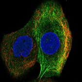 Anti-MMP14 antibody produced in rabbit Prestige Antibodies® Powered by Atlas Antibodies, affinity isolated antibody, buffered aqueous glycerol solution