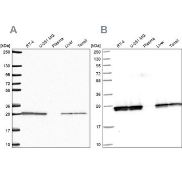 Anti-TPI1 antibody produced in rabbit Prestige Antibodies&#174; Powered by Atlas Antibodies, affinity isolated antibody