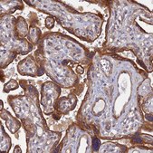 Anti-NCAPG antibody produced in rabbit Prestige Antibodies® Powered by Atlas Antibodies, affinity isolated antibody, buffered aqueous glycerol solution