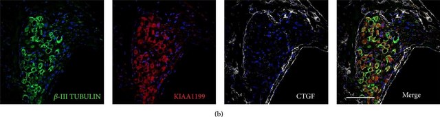 Monoclonal Anti-&#946;-Tubulin III antibody produced in mouse clone SDL.3D10, ascites fluid