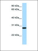 Anti-VDAC3 affinity isolated antibody