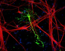 Human Cortical Astrocytes Human iPSC line, Fully differentiated, Healthy Male Control (no known neurological disorders), Cryopreserved