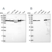 Anti-TRAP1 antibody produced in rabbit Prestige Antibodies® Powered by Atlas Antibodies, affinity isolated antibody, buffered aqueous glycerol solution