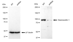 KD-Validated Anti Desmocollin 1 Antibody, clone 23GB5210, Rabbit Monoclonal clone 23GB5210, recombinant rabbit monoclonal, expressed in HEK293 cells