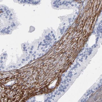 Anti-EMILIN1 antibody produced in rabbit Prestige Antibodies&#174; Powered by Atlas Antibodies, affinity isolated antibody, buffered aqueous glycerol solution