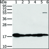 Anti-MTFP1 antibody produced in rabbit affinity isolated antibody