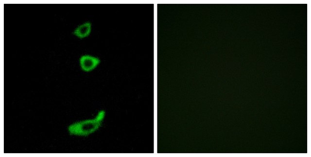 Anti-CRHR1 antibody produced in rabbit affinity isolated antibody