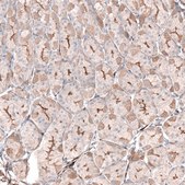 Anti-LRRC15 antibody produced in rabbit Prestige Antibodies® Powered by Atlas Antibodies, affinity isolated antibody, buffered aqueous glycerol solution
