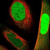 Anti-NANS antibody produced in rabbit Prestige Antibodies® Powered by Atlas Antibodies, affinity isolated antibody, buffered aqueous glycerol solution