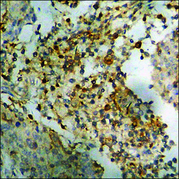 Anti-phospho-Lyn (pTyr507) antibody produced in rabbit affinity isolated antibody