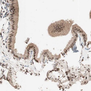 Anti-NFRKB antibody produced in rabbit Ab2, Prestige Antibodies&#174; Powered by Atlas Antibodies, affinity isolated antibody, buffered aqueous glycerol solution