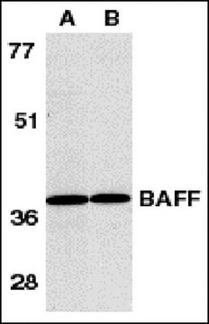 Anti-BAFF Antibody, CT Chemicon&#174;, from rabbit