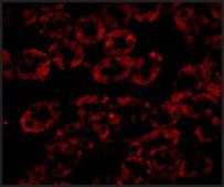 Anti-NPC1 antibody produced in rabbit affinity isolated antibody, buffered aqueous solution
