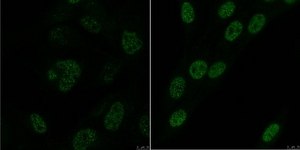 Anti-ARID1B Antibody, clone 3D9.1 clone 3D9.1, from mouse