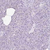 Anti-HSPA1A antibody produced in rabbit Prestige Antibodies® Powered by Atlas Antibodies, affinity isolated antibody, buffered aqueous glycerol solution