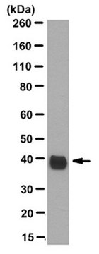 Anti-Aldolase C Antibody, N-Term, clone 4A9 clone 4A9, from mouse