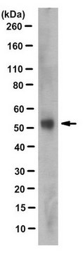 Anti-MGAT2 Antibody, clone 4A5.2 clone 4A5.2, from mouse