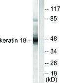 Anti-Keratin 18 antibody produced in rabbit affinity isolated antibody
