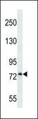 ANTI-PLOD1 (N-TERM) antibody produced in rabbit IgG fraction of antiserum, buffered aqueous solution