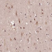 Anti-TMX2 antibody produced in rabbit Prestige Antibodies® Powered by Atlas Antibodies, affinity isolated antibody, buffered aqueous glycerol solution