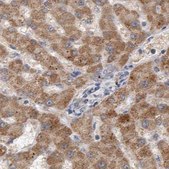 Anti-SCO1 antibody produced in rabbit Prestige Antibodies® Powered by Atlas Antibodies, affinity isolated antibody, buffered aqueous glycerol solution, Ab1