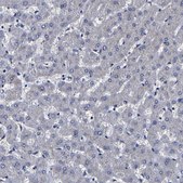 Anti-CPA2 antibody produced in rabbit Prestige Antibodies® Powered by Atlas Antibodies, affinity isolated antibody, buffered aqueous glycerol solution, Ab1