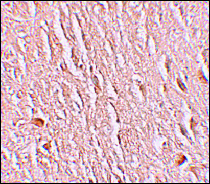 Anti-LRRTM3 antibody produced in rabbit affinity isolated antibody