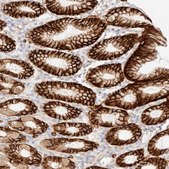 Anti-FAM129B antibody produced in rabbit Prestige Antibodies® Powered by Atlas Antibodies, affinity isolated antibody, buffered aqueous glycerol solution, Ab4