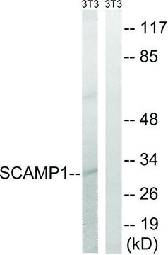 Anti-SCAMP1 antibody produced in rabbit affinity isolated antibody