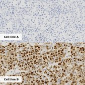 Breast Analyte Control Cell line controls for immunohistochemistry and in situ hybridization