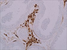 Steroidogenic Acute Regulatory Protein (STAR) (EP226) Rabbit Monoclonal Primary Antibody