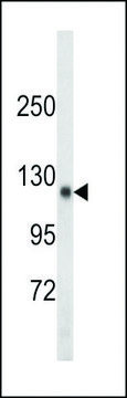 ANTI-SDCCAG33 (CENTER) antibody produced in rabbit purified immunoglobulin, buffered aqueous solution