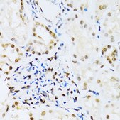 Anti-MAPK3 antibody produced in rabbit