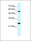 Anti-SMAD1 (AB2) antibody produced in rabbit IgG fraction of antiserum