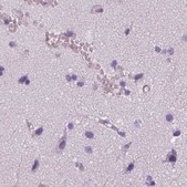 Anti-KRT25 antibody produced in rabbit Prestige Antibodies® Powered by Atlas Antibodies, affinity isolated antibody