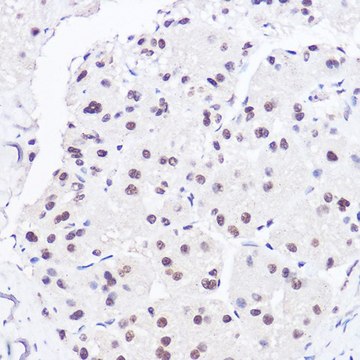 Anti- BRG1/SMARCA4 antibody produced in rabbit