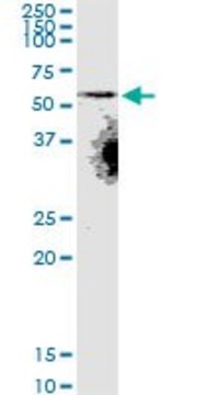 Monoclonal Anti-SLC22A8 antibody produced in mouse clone 3C11, purified immunoglobulin, buffered aqueous solution