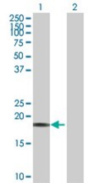 Anti-CAPS antibody produced in rabbit purified immunoglobulin, buffered aqueous solution