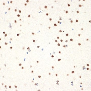 Anti-NAT10 antibody produced in rabbit