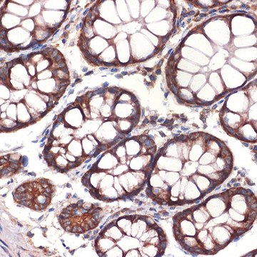 Anti-CC2D1A Antibody, clone 5Y6S6, Rabbit Monoclonal